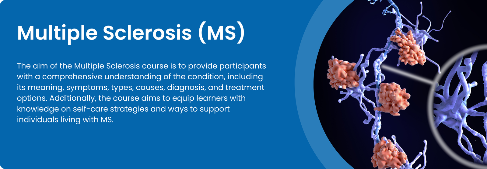 Multiple Sclerosis (MS)